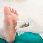Diabetes Foot Care